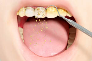 Hygiène Dentaire entretien dents